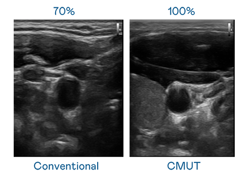 Ultra-wide bandwidth offers high-quality images